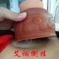 无极玄灸器紫砂艾灸器无极神灸阴阳悬灸器**厂家 ****